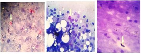 Showing Protozoa Of Other Organs A Lung Impression Smear Stained With Download Scientific