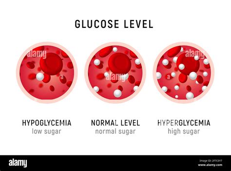 Glucose Blood Level Sugar Test Diabetes Insulin Hypoglycemia Or