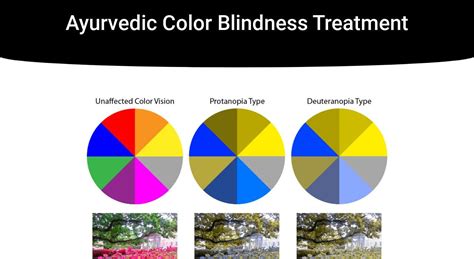 Ayurvedic Color Blindness Treatment | IrisTech