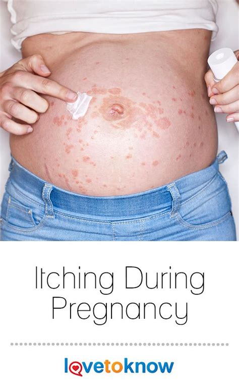 Itching During Pregnancy Causes And Treatments Artofit