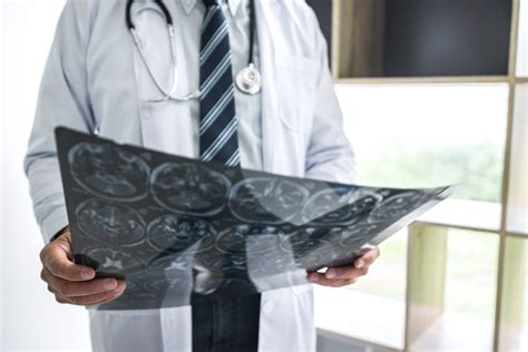 Demystifying Strokes: Separating Fact from Fiction - Crisp Regional