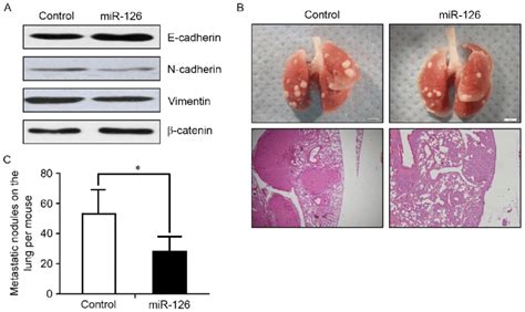 Mir Inhibits Metastasis Of Lung Cancer Cells In Vivo A Western