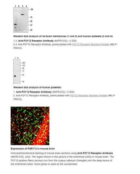 Gpcr Antibody And Proteins 고마바이오텍