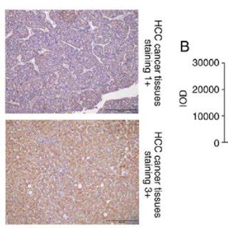 Immunohistochemical Analysis Of WIPI2 Expression In Human Tissue