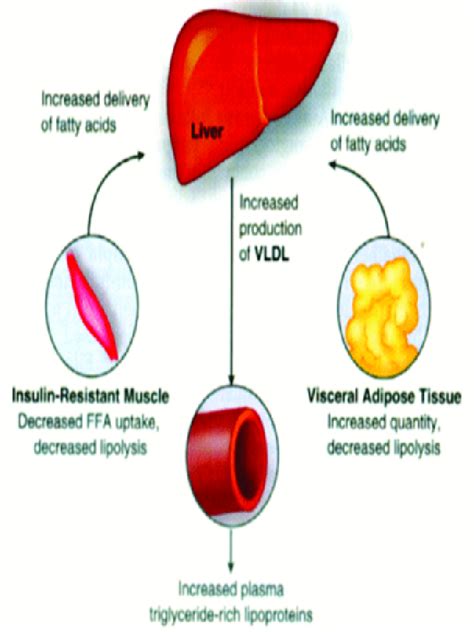 Pathogenesis Of Dyslipidemia