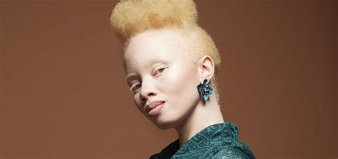 Thando Hopa Primera Modelo Albina Y Activista Sudafricana