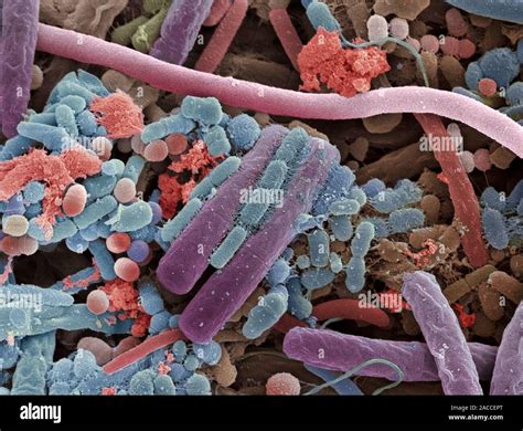 Tongue bacteria. Coloured scanning electron micrograph (SEM) of bacteria on the surface of a ...