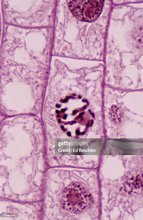 Plant Mitosis Prophase Root Tip Shows Chromosomes Nucleolus Nuclear