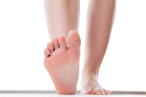 5 Cara Mengobati Kaki Yang Melepuh Jangan Dipencet Okezone Health