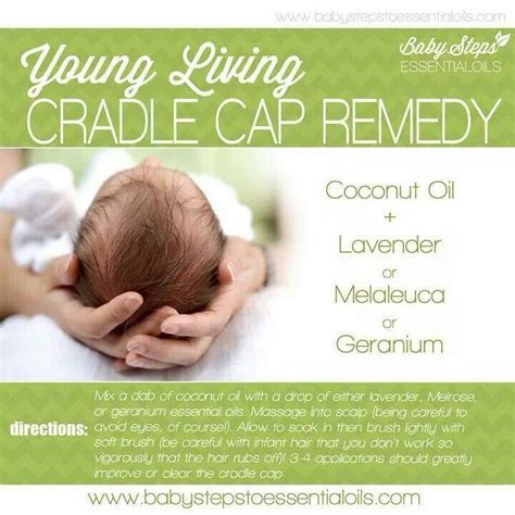 Cradle Cap Remedy Babies Pinterest