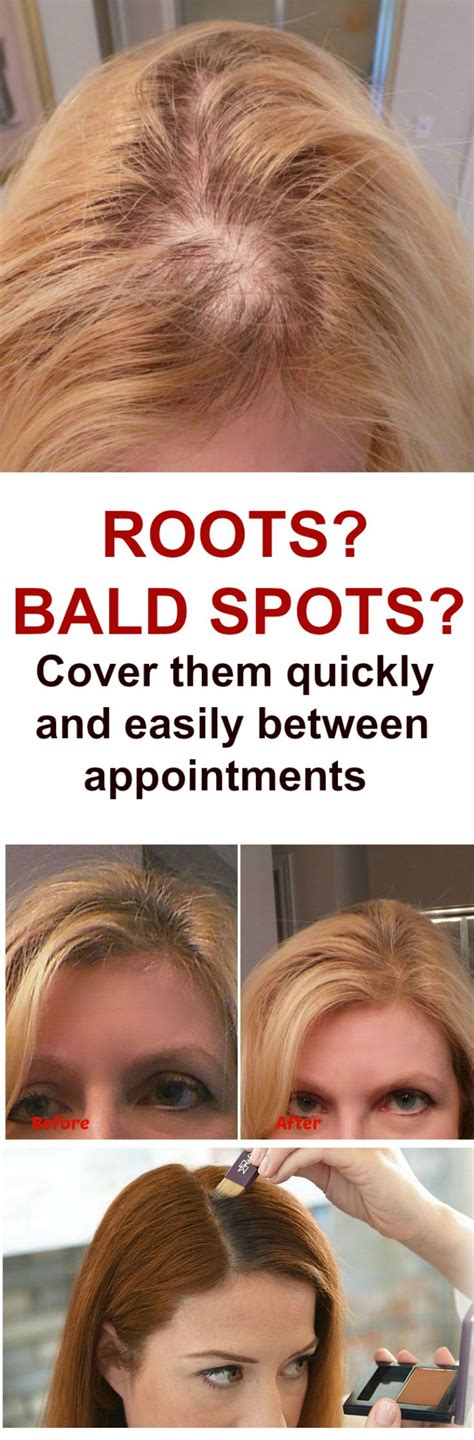 How To Cover Bald Spot With Makeup - Mugeek Vidalondon