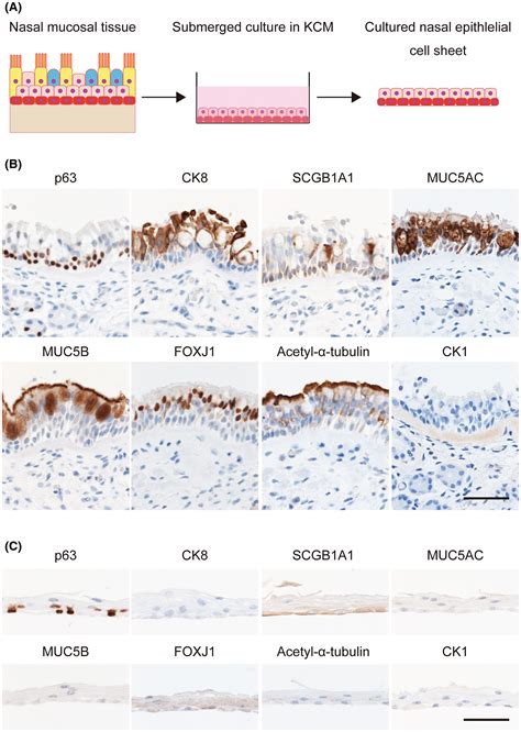 Analysis Of The Potential Of Human Cultured Nasal Epithelial Cell