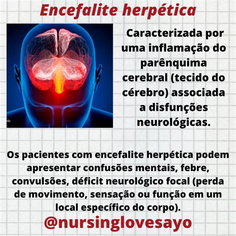 Encefalite Herpética O Que É