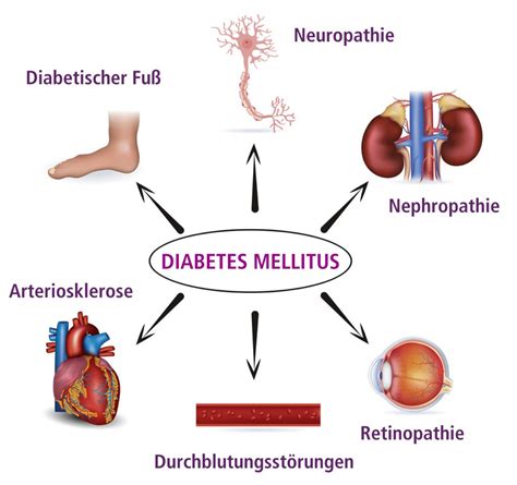 Diabetes mellitus PRAXIS FÜR ALLGEMEINMEDIZIN