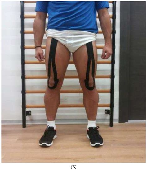 Jfmk Free Full Text Acute Effects Of Kinesio Taping On Functional