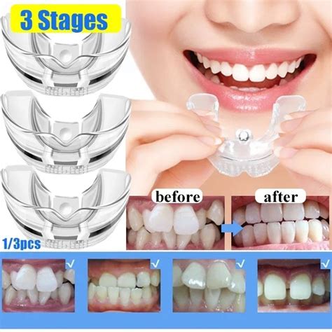 Silicone Teeth Trainer Para Adultos Aparelho Ortod Ntico Dent Rio