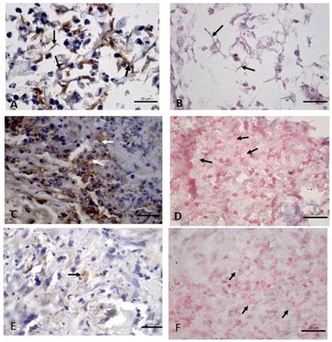 Tropicalmed Free Full Text Comparison Between Colorimetric In Situ