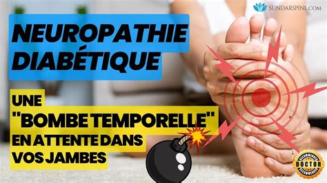 Pr Venir Les Douleurs Aux Jambes Dues Au Diab Te Neuropathie