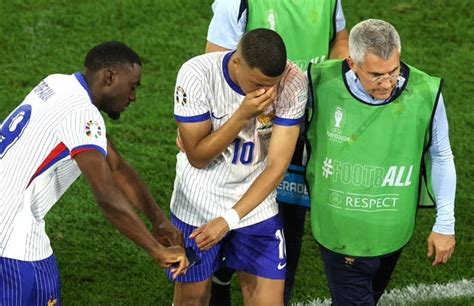 Kylian Mbappe si sottoporrà ad un intervento chirurgico per la frattura