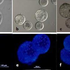 A few representative images of blastocyst and Hoechst staining of ... 