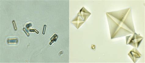 Different morphologies of crystals made of calcium oxalate dihydrate ...