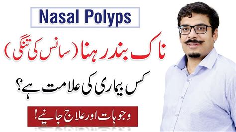 Nasal Polyps Causes Symptoms And Treatment Naak Ki Haddi By Dr M