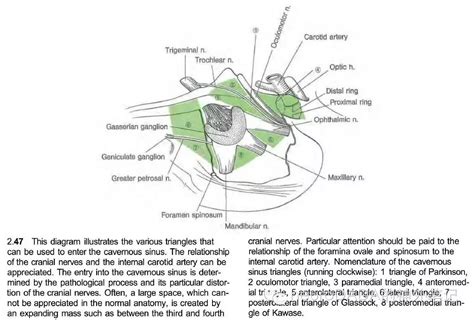 海绵窦三角 解剖图集 脑医汇 神外资讯 神介资讯