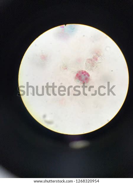 Entamoeba Histolytica Trophozoite Stage Light Microscope Foto Stok 1268320954 Shutterstock