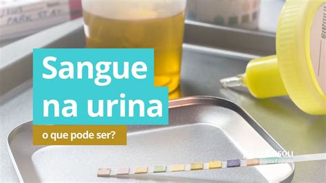 Sangue Na Urina Urologista Responde Youtube