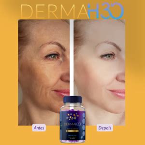 Derma H Funciona Mesmo Onde Comprar Pre O Site Oficial