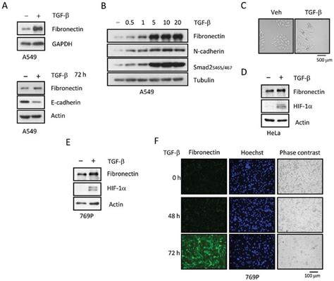 A Cells Treated With Tgf Undergo Emt A Tgf Treatment For H