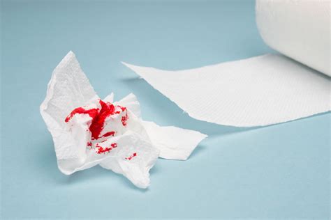 Bleeding Hemorrhoids Common Causes Symptoms And Treatment