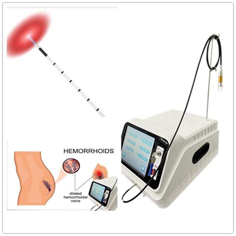 Fistula And Hemorrhoids Diode Laser 1470nm 980nm Machine China Laser