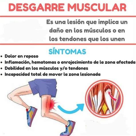 DESGARRE MUSCULAR Prevención causas y tratamiento Salud Diez