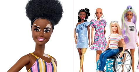 Barbie dolls feature vitiligo, hair loss, and prosthetics to boost diversity