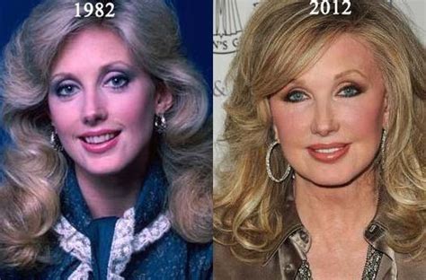 Morgan Fairchild Plastic Surgery For Great Look At 65