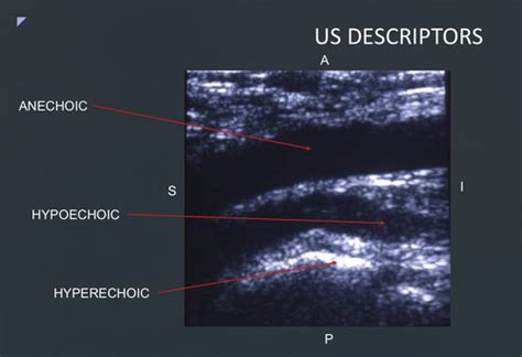 ultrasound (labs exam) Flashcards | Quizlet