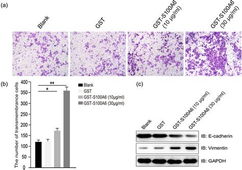 S A Promotes Proliferation And Migration Of Hepg Cells Via