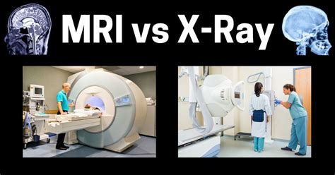 MRI Vs X Ray What S The Difference