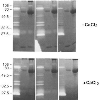 The Effect Of Varied PH On The Caseinolytic Proteinase Activities Of