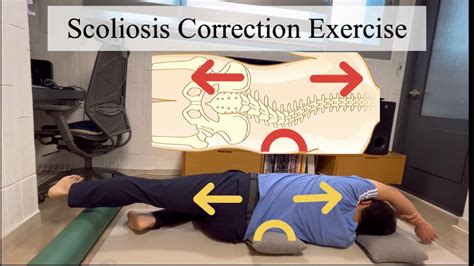 Scoliosis Exercise In Side Lying For Lumbar Curve On Right Side Youtube