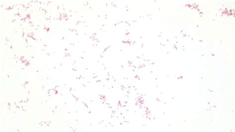 Micrograph Escherichia Coli 5d Endospore 1000x P000068 Oer Commons