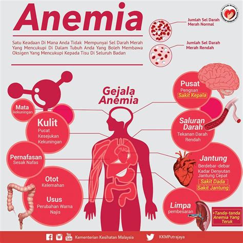 Tanda Tanda Anemia Di Jari Pena Menari