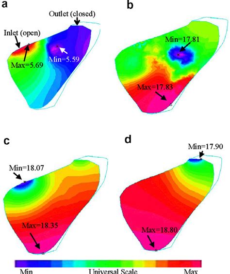 Figure 1 From In Vivo MRI Based 3D FSI RV LV Models For Human Right