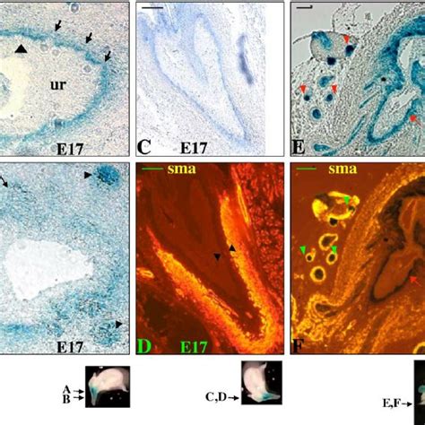 BMP7 LacZ Expression In The Prostate Epithelium And Mesenchyme