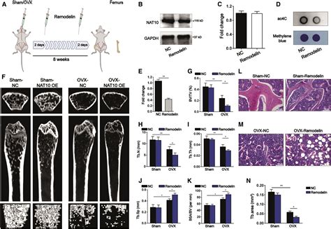 Ac4C Acetylation Of RUNX2 Catalyzed By NAT10 Spurs Osteogenesis Of