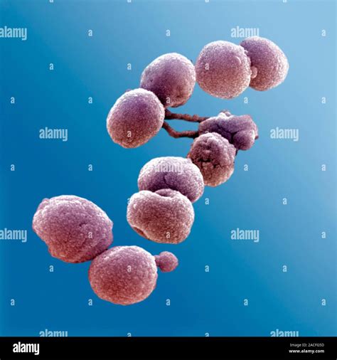 Streptococcus Pneumoniae Coloured Scanning Electron Micrograph Sem