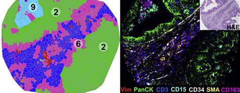 Spatial Phenotyping Adds A New Dimension To Discovery Biology