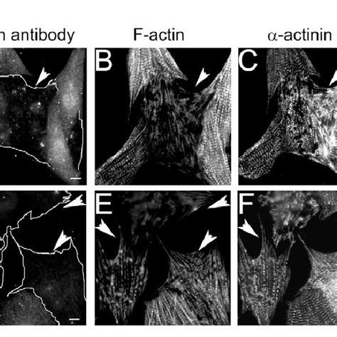 Adfcofilins Are Required For Correct Assembly Of Actin Filaments In