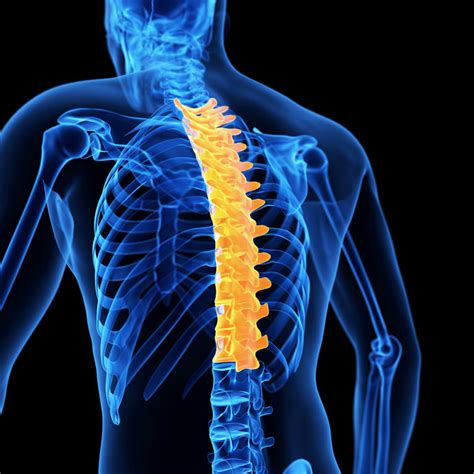 Causes Of Upper Back Pain Douglas Chiropractic And Physiotherapy Clinic